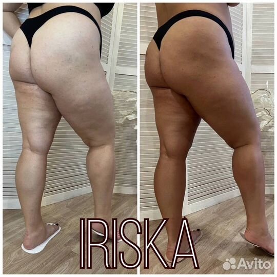 Моментальный загар