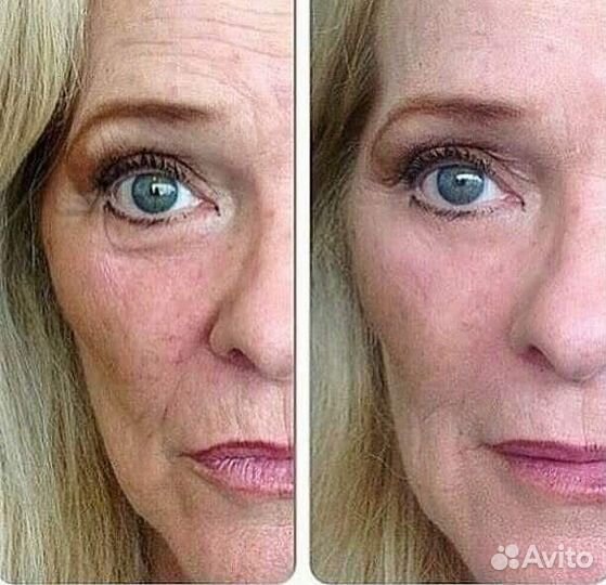 Крем Instantly ageless USA