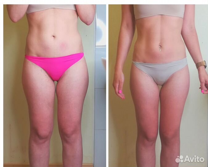 LPG массаж лица и тела на Комендантском проспекте