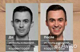 Ушной корректор от лопоухости