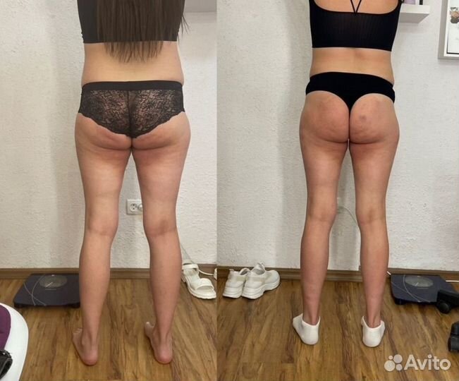 Горящая жопа аппаратный массаж