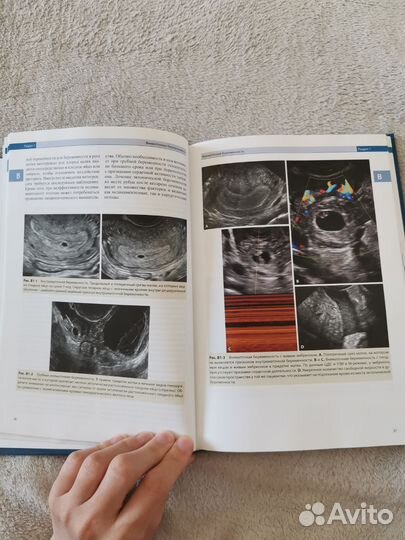 Узи в гинекологии