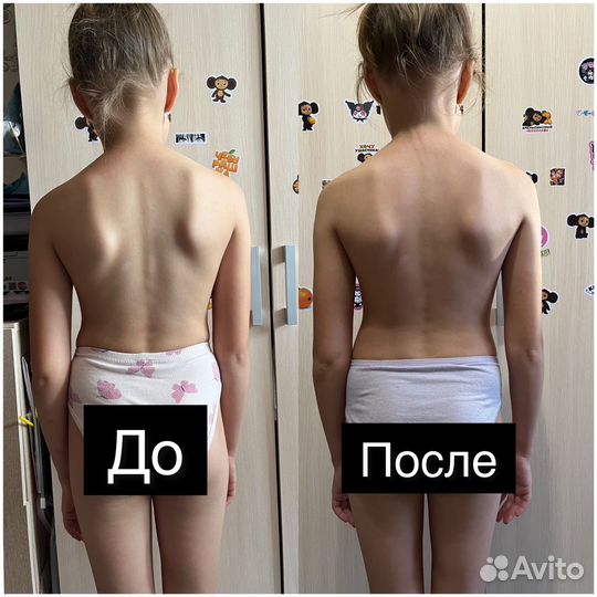 Детский массаж