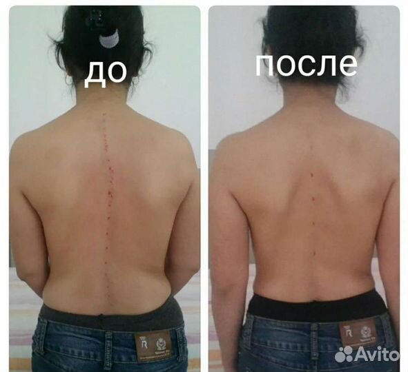 Массаж костоправ