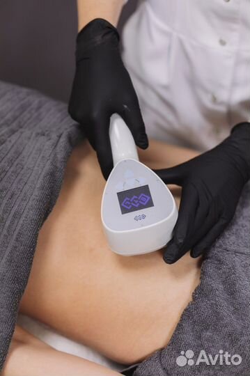 RF-лифтинг, омоложение -10 лет