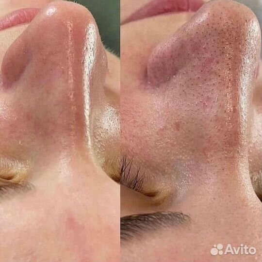 Обучение косметолог - эстетист