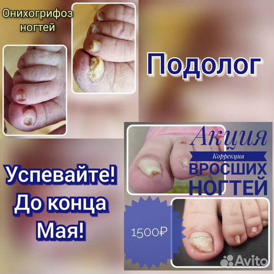 Педикюр-подолог, маникюр, депиляция, брови