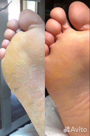 Мужской маникюр и педикюр