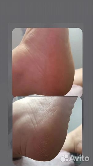 Маникюр, SMART педикюр