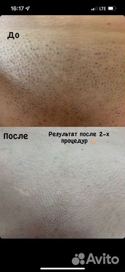 Студия лазерной эпиляции