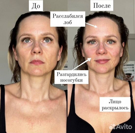 Массаж лица