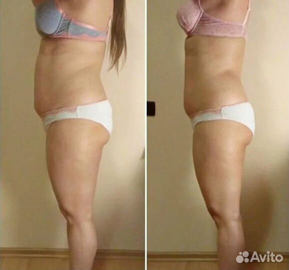 Услуги кавитации/Кавитация