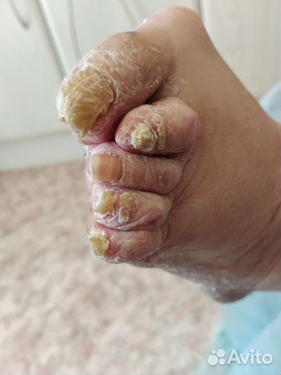 Услуги подолога