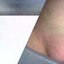 Шугаринг,депиляция воском, пирсинг Девяткино, Мурино