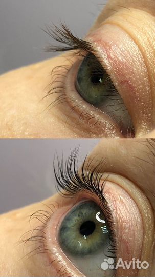 Педикюр smart/kart и Ламинирование Ресниц Inlei