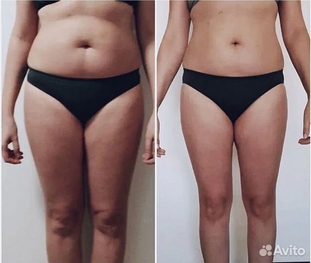 Нужны модели на массаж