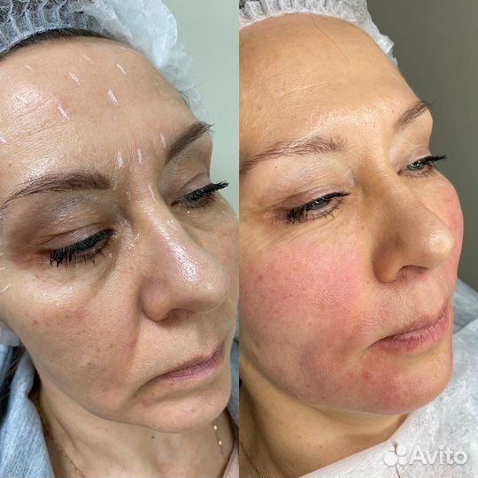 Модели губы