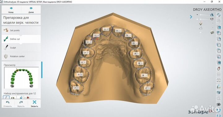 Maestro 3D Dental Studio 6.0 3shape OrthoAnalyzer