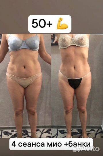 Аппаратный массаж коррекция фигуры