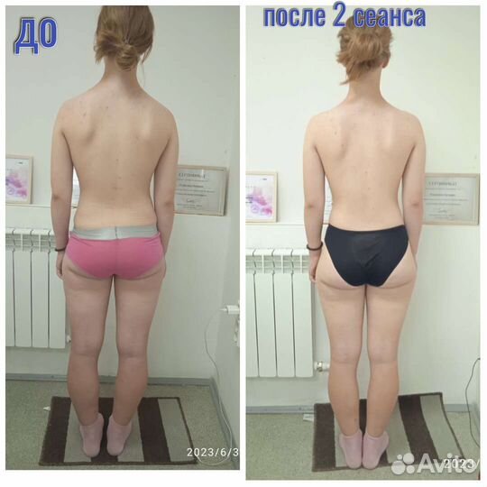 Лечебный массаж Остеопластика по метод Виталия Ким