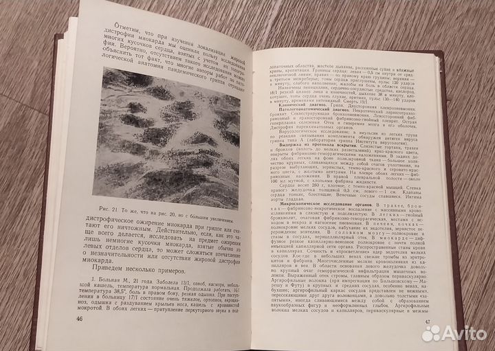 Поражение сердечно-сосудистой системы при гриппе