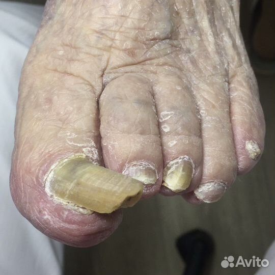 Модель на педикюр