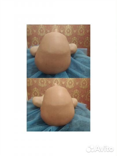 Альтернативная медицина