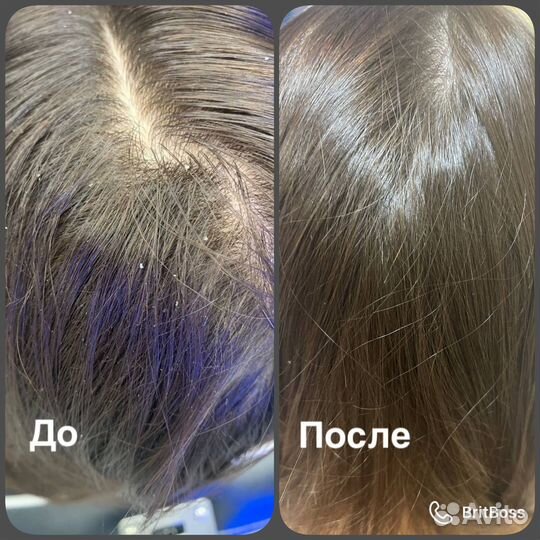 Трихолог-эстетист/технолог/реконструкция волос