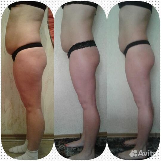 Массаж лица,антицеллюлитный,лимфожренажный