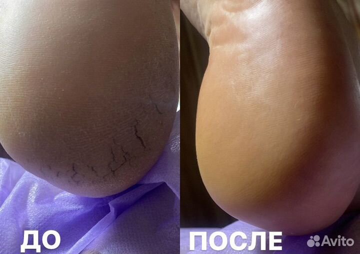 Курсы педикюра