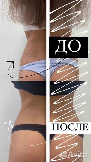 Безоперационно выравниваю линию талии, убираю бока