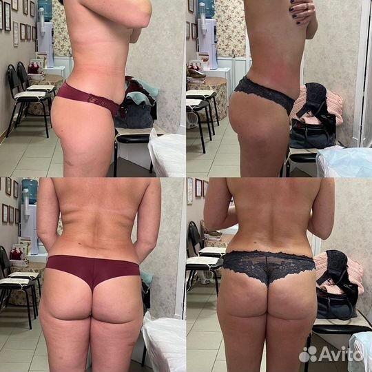 Коррекция фигуры