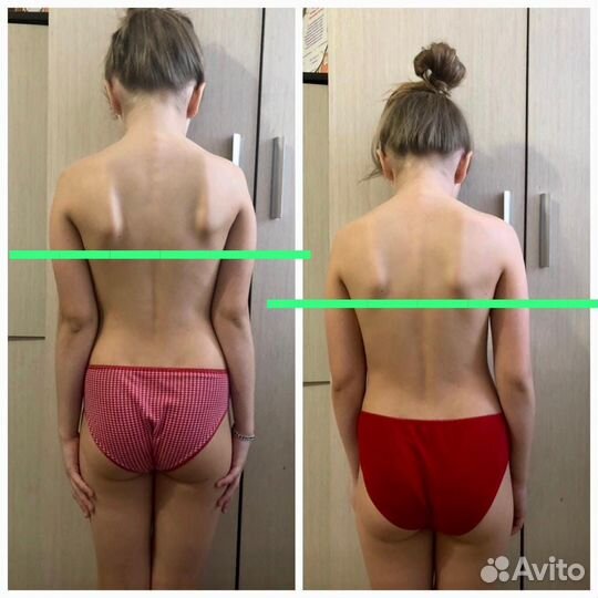 Детский Массаж, женский массаж, лечебный массаж