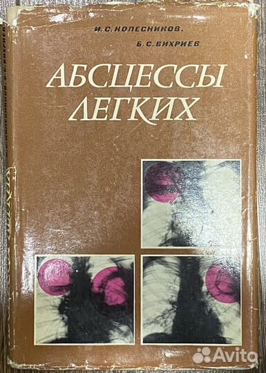 Абсцессы легких