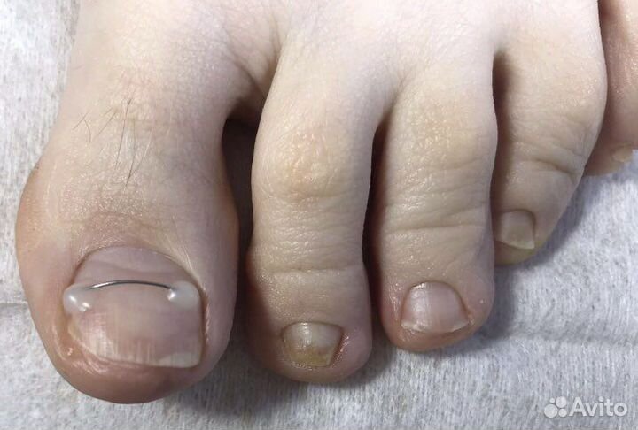 Подолог, педикюр, маникюр