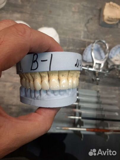 Зуботехническая лаборатория. Зубной Техник