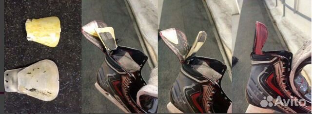 Задник на коньках. Задник на коньках. Bauer 1x. Ремонт коньков. Ремкомплект задника конька.