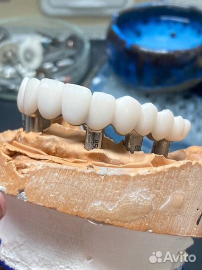 Моделирование Прототипы CAD\CAM зубной техник