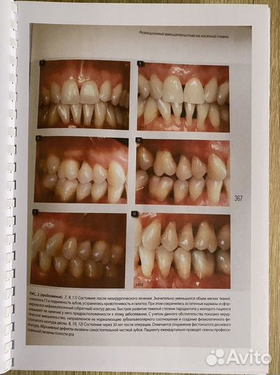 Диагностика и лечение заболеваний пародонта