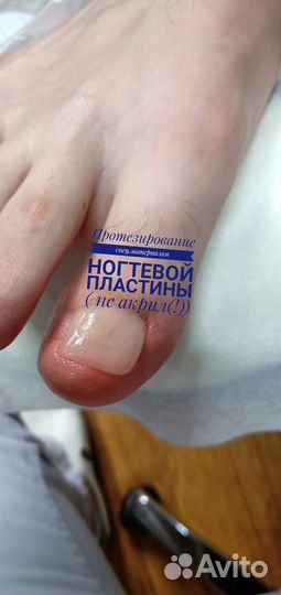 Подолог, педикюр