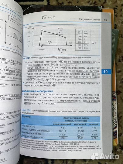 Справочник по эхокг Вилкенсхоф Крук