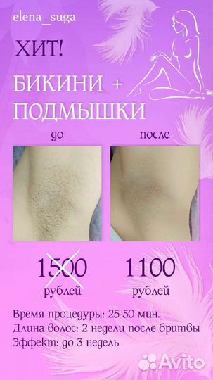 Шугаринг мужской женский