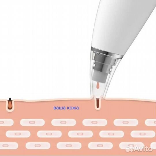 Вакуум чистка лица пор угрей чёрных новый Xiaomi