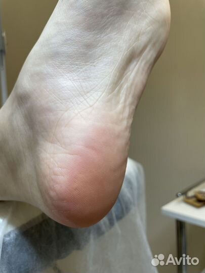 Модель на педикюр