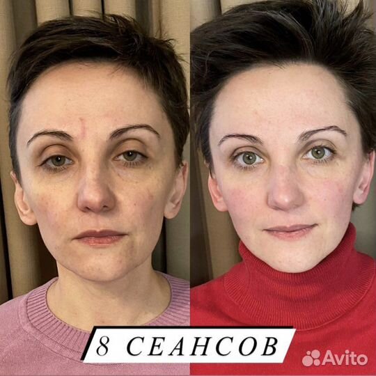 Миофасциальный массаж лица и головы