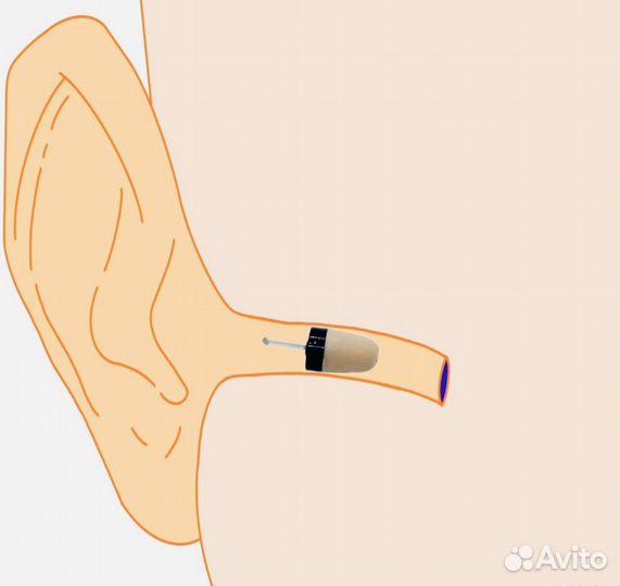 Капсульный микронаушник для экзаменов