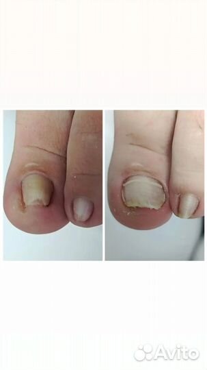 Педикюр Подолог Маникюр