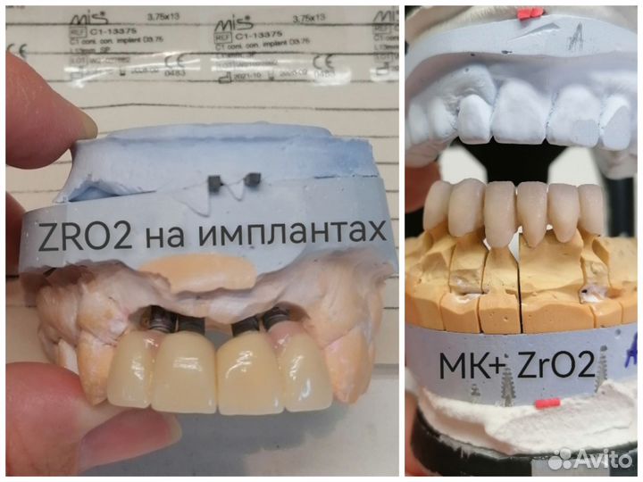 Зуботехнические работы