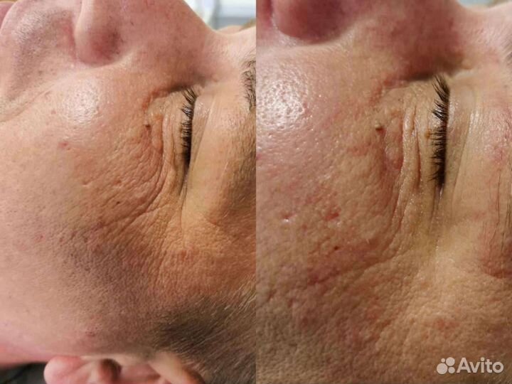 Услуги косметолога