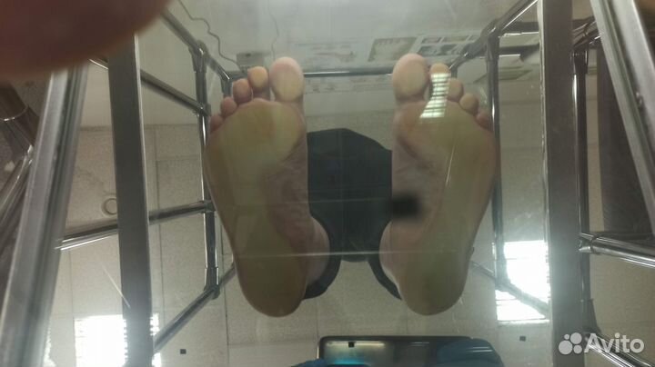 Стельки ортопедические индивидуальные изготовление